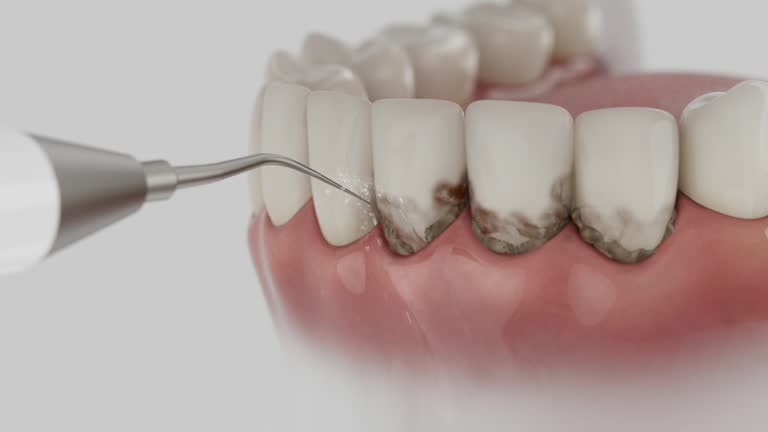 Trusted Teeth Cleaning And Checkup service in Fallbrook, CA - Dentist Open Now
